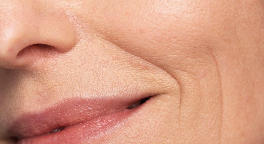 v_skin
